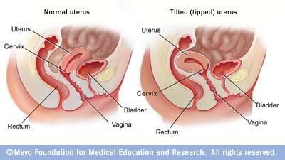 best of After uterus orgasm hard Pregnant