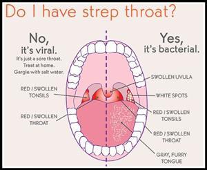 Lem /. L. reccomend Streph throat in adults