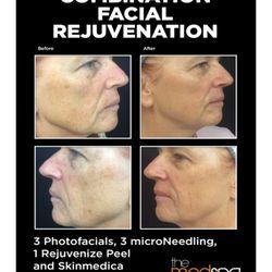 best of Rejuvenation smyrna Facial