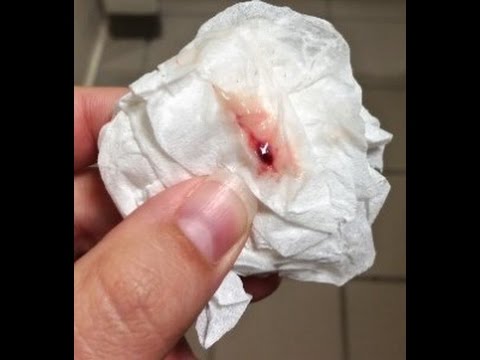 Blood coming out of my vagina