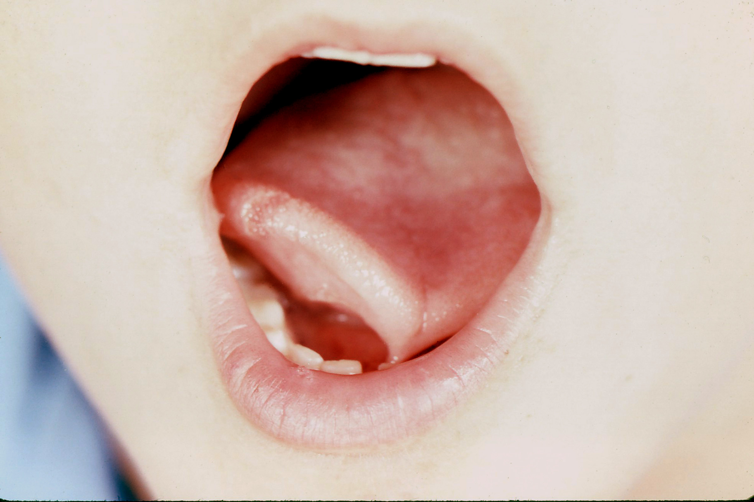 best of Tounge toungue Lick tongue skink toung
