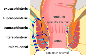 best of Fluid from the leakage anus Serous