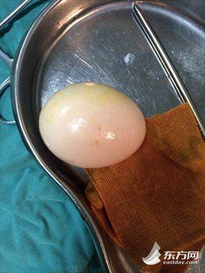 Twizzler reccomend Boil egg in pussy