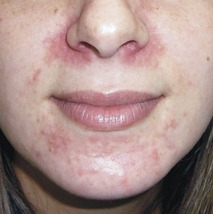 best of Irritations Facial skin
