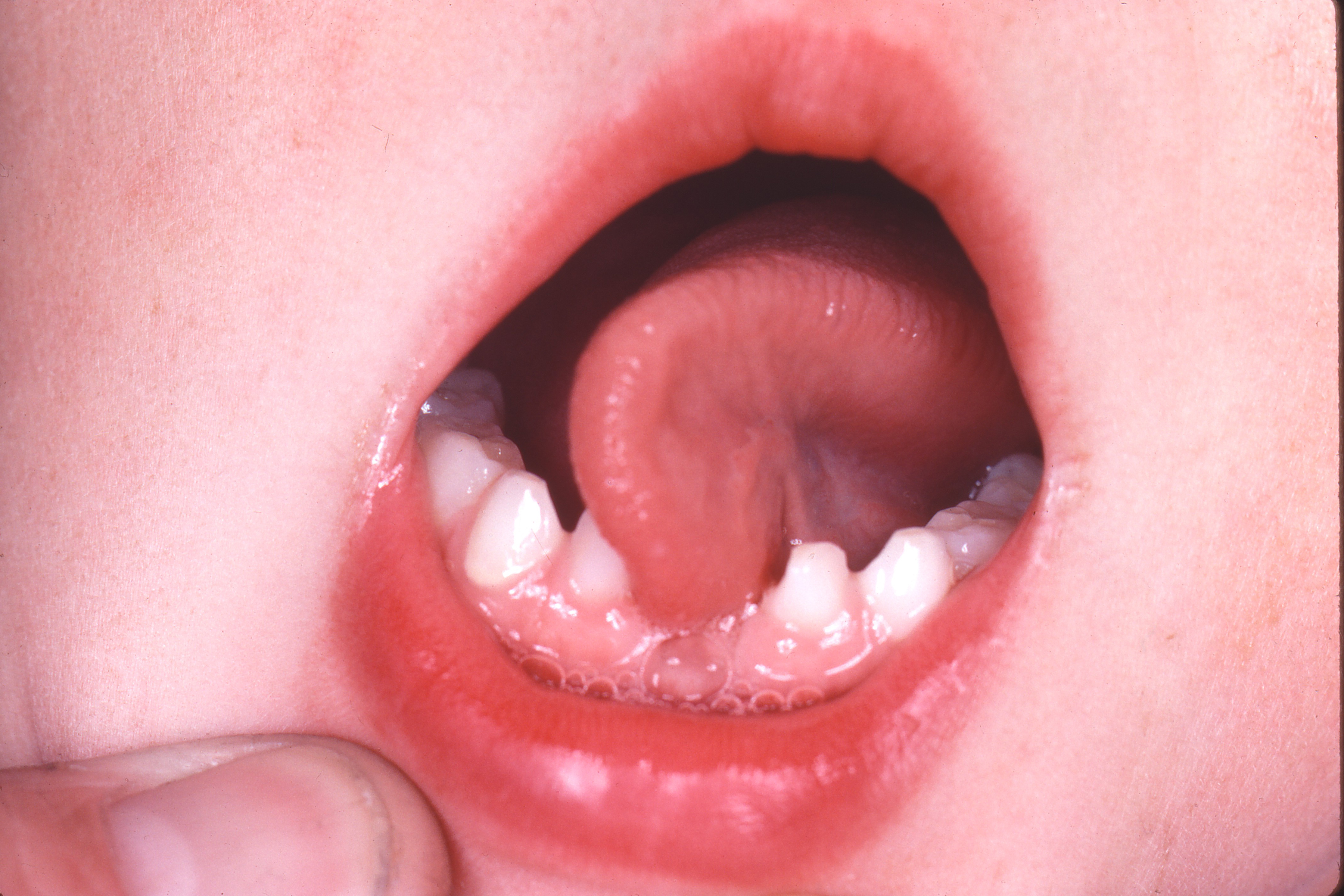 Lick skink tongue toung tounge toungue