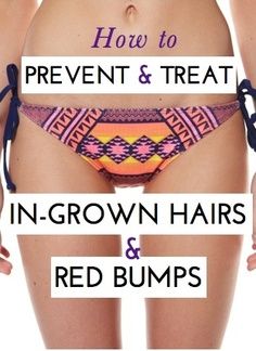 Mr. P. reccomend Red bumps and irritation bikini