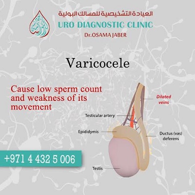 Sherry reccomend Verices in scrotum and low sperm count