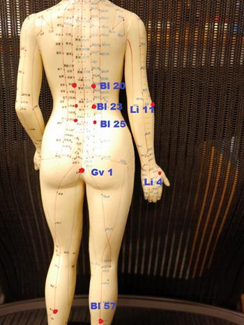 Acupuncture for anal fissure