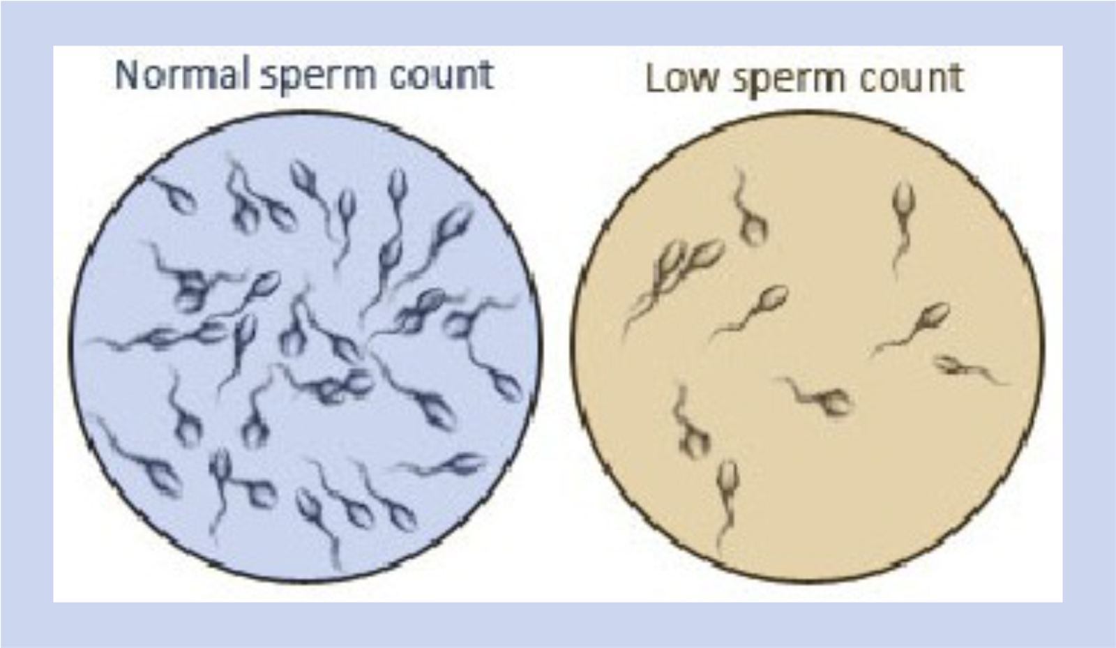 Low sperm count symptoms - Nude photos