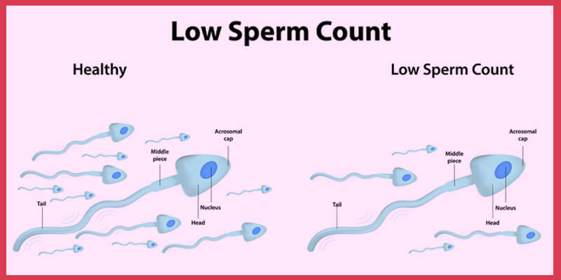 Kraken reccomend Casues of less in sperm count