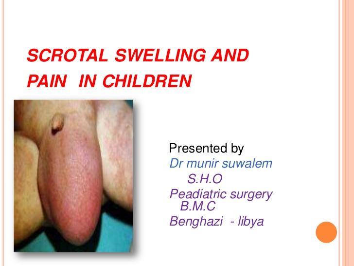 best of Between anus scrotum Swelling and