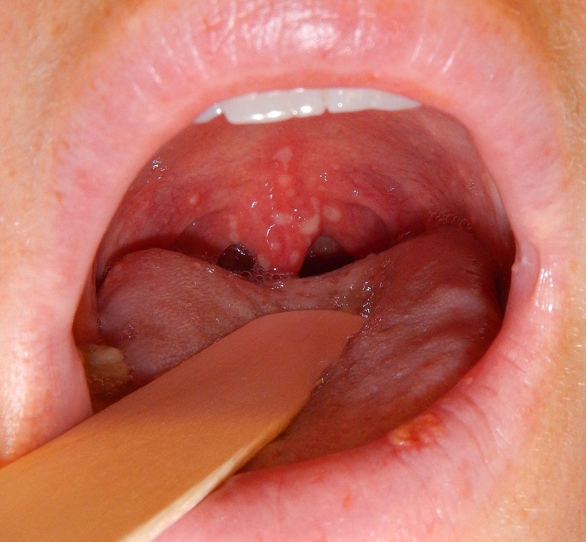 Tongue hurts after cunnilingus
