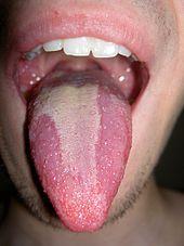 Tongue hurts after cunnilingus